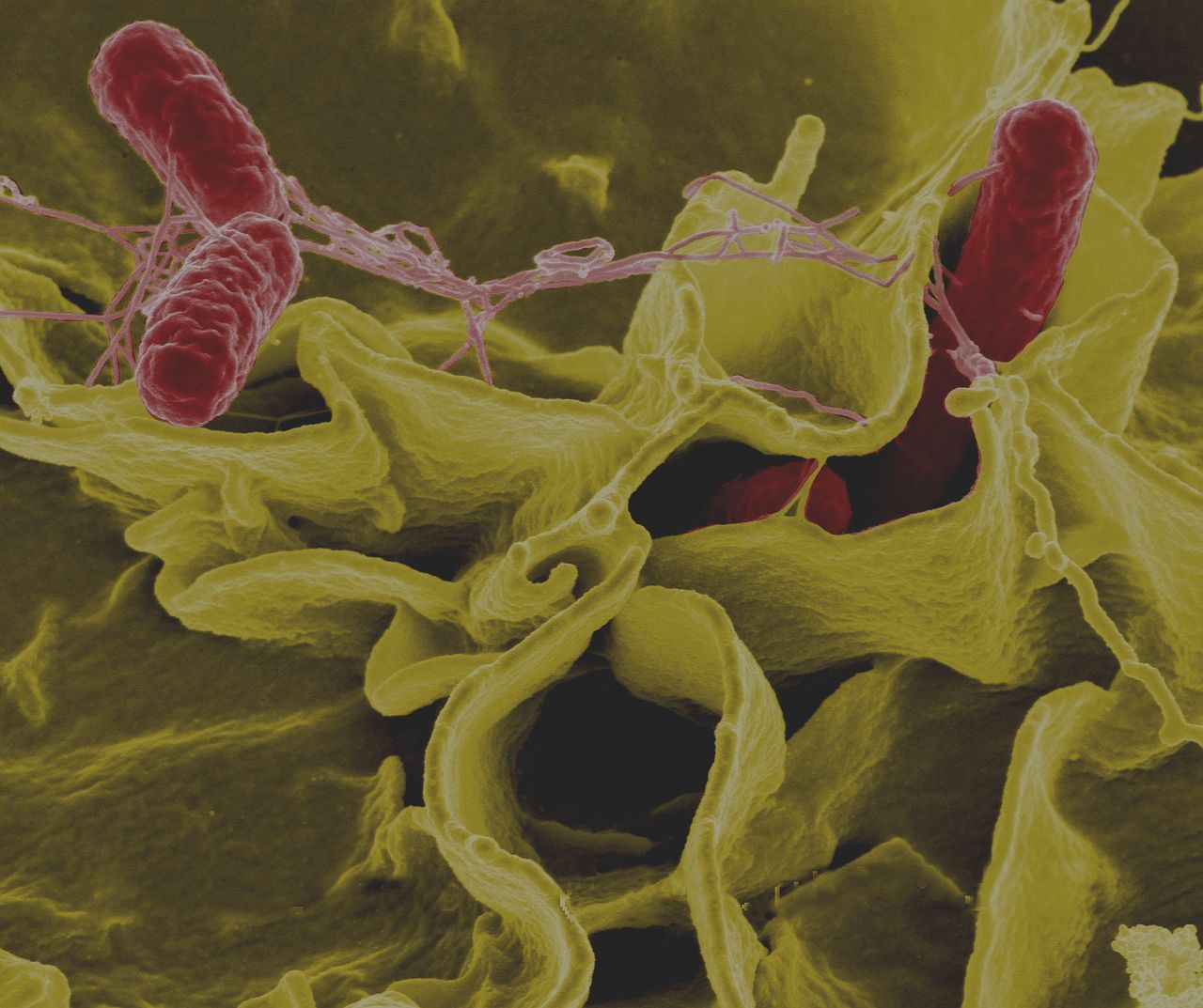 Le stress et le microbiote intestinal. 